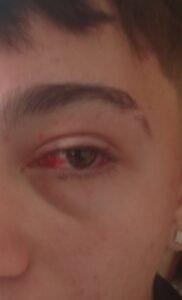 Preocupación en Venado Tuerto: una madre denunció que su hijo fue atacado por menores armados en Plaza San Martín